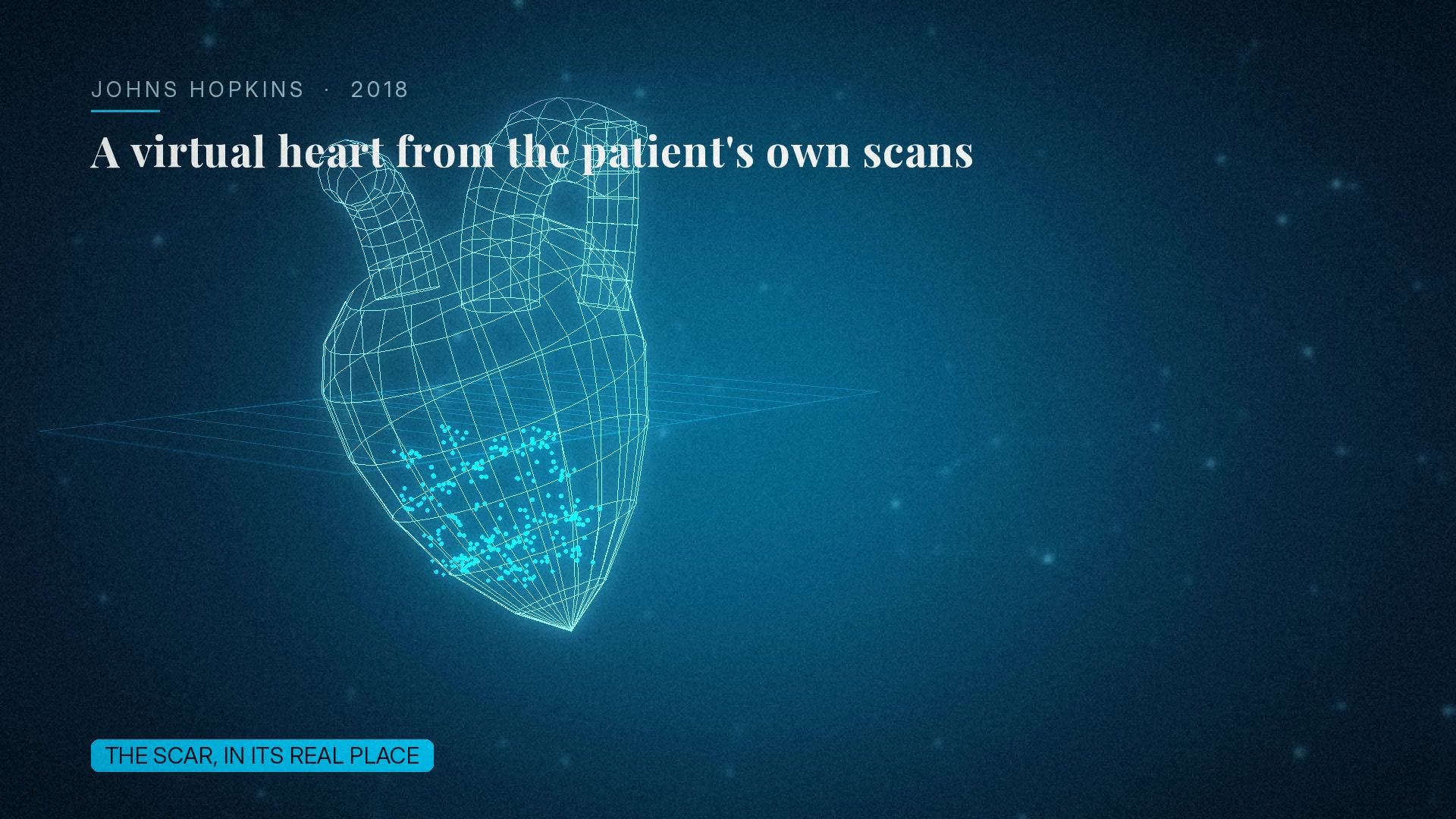 A patient's heart and its digital twin side by side